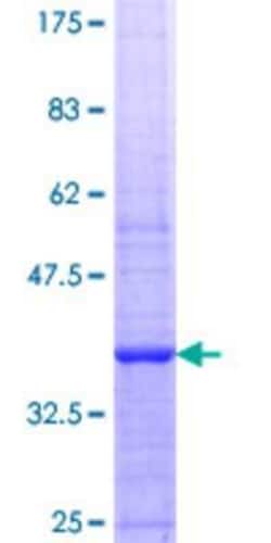 Novus Biologicals Recombinant Human RECQ1 GST (N-Term) Protein 10 &mu;g | Buy Online | Novus Biologicals&trade; | Fisher Scientific