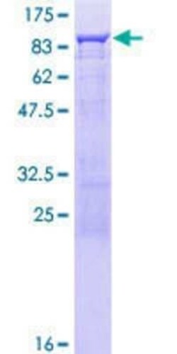 Novus Biologicals Recombinant Human RelB GST (N-Term) Protein 25 &mu;g | Buy Online | Novus Biologicals&trade; | Fisher Scientific