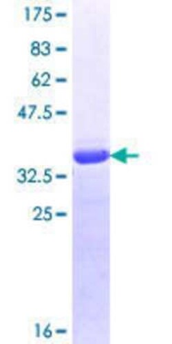 Novus Biologicals Recombinant Human RENT1/UPF1/hUPF1 GST (N-Term) Protein 10 &mu;g | Buy Online | Novus Biologicals&trade; | Fisher Scientific
