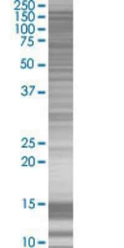 Novus Biologicals&trade;&nbsp;Ret 293T Cell Transient Overexpression Lysate