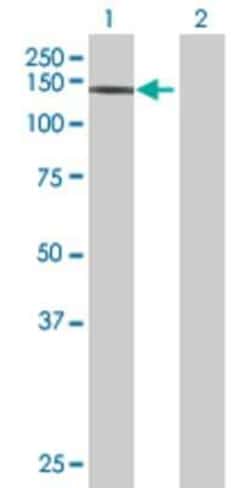 Novus Biologicals Ret 293T Cell Transient Overexpression Lysate 0,1 mL | Buy Online | Novus Biologicals&trade; | Fisher Scientific