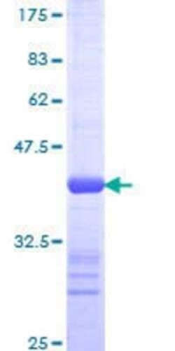 Novus Biologicals Recombinant Human RFC2 GST (N-Term) Protein 10 &mu;g | Buy Online | Novus Biologicals&trade; | Fisher Scientific