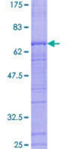 Novus Biologicals Recombinant Human RFC3 GST (N-Term) Protein 25 &mu;g | Buy Online | Novus Biologicals&trade; | Fisher Scientific