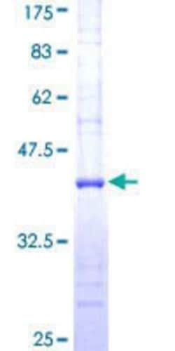 Novus Biologicals Recombinant Human RFC3 GST (N-Term) Protein 25 &mu;g | Buy Online | Novus Biologicals&trade; | Fisher Scientific
