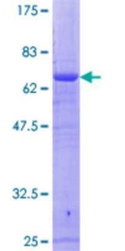 Novus Biologicals Recombinant Human RFC4 GST (N-Term) Protein 10 &mu;g | Buy Online | Novus Biologicals&trade; | Fisher Scientific