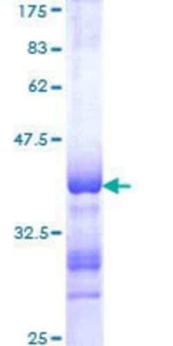 Novus Biologicals Recombinant Human RFX1 GST (N-Term) Protein 25 &mu;g | Buy Online | Novus Biologicals&trade; | Fisher Scientific
