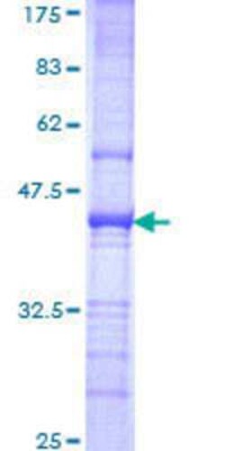 Novus Biologicals Recombinant Human RFX2 GST (N-Term) Protein 10 &mu;g | Buy Online | Novus Biologicals&trade; | Fisher Scientific