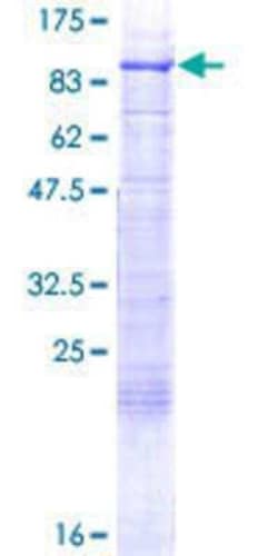 Novus Biologicals Recombinant Human RFX5 GST (N-Term) Protein 25 &mu;g | Buy Online | Novus Biologicals&trade; | Fisher Scientific