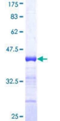 Novus Biologicals Recombinant Human RFX5 GST (N-Term) Protein 10 &mu;g | Buy Online | Novus Biologicals&trade; | Fisher Scientific