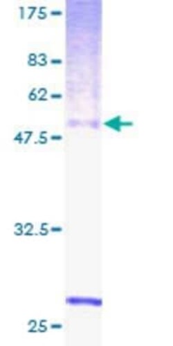 Novus Biologicals Recombinant Human RGR GST (N-Term) Protein 10 &mu;g | Buy Online | Novus Biologicals&trade; | Fisher Scientific