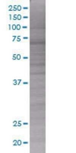 Novus Biologicals RGS1 293T Cell Transient Overexpression Lysate 0.1 mL | Buy Online | Novus Biologicals&trade; | Fisher Scientific