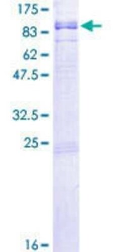 Novus Biologicals Recombinant Human RGS12 GST (N-Term) Protein 10 &mu;g | Buy Online | Novus Biologicals&trade; | Fisher Scientific