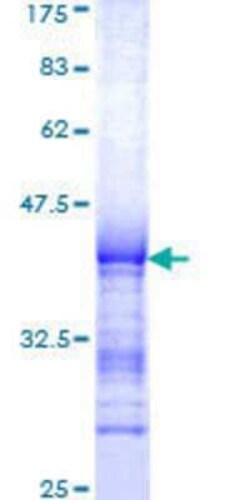 Novus Biologicals Recombinant Human RGS12 GST (N-Term) Protein 25 &mu;g | Buy Online | Novus Biologicals&trade; | Fisher Scientific