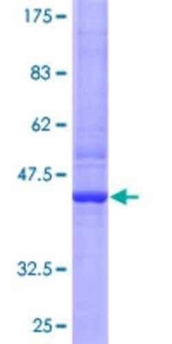 Novus Biologicals Recombinant Human RGS13 GST (N-Term) Protein 10 &mu;g | Buy Online | Novus Biologicals&trade; | Fisher Scientific