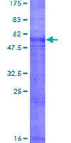 Novus Biologicals Recombinant Human RHAG GST (N-Term) Protein 2 &mu;g | Buy Online | Novus Biologicals&trade; | Fisher Scientific