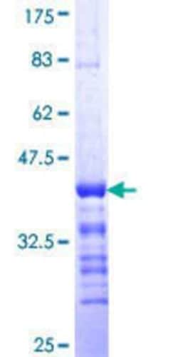 Novus Biologicals Recombinant Human GRK1 GST (N-Term) Protein 10 &mu;g | Buy Online | Novus Biologicals&trade; | Fisher Scientific