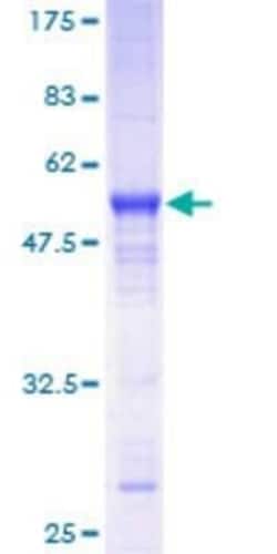Novus Biologicals Recombinant Human Rit2 GST (N-Term) Protein 25 &mu;g | Buy Online | Novus Biologicals&trade; | Fisher Scientific