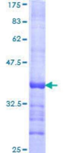 Novus Biologicals Recombinant Human RING1 GST (N-Term) Protein 10 &mu;g | Buy Online | Novus Biologicals&trade; | Fisher Scientific