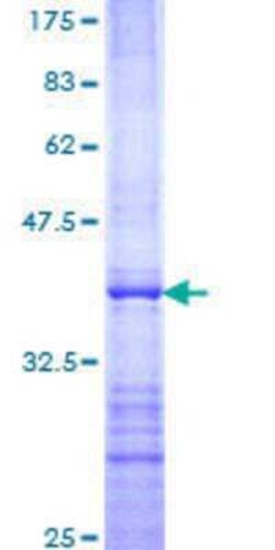 Novus Biologicals Recombinant Human Rit1 GST (N-Term) Protein 25 &mu;g | Buy Online | Novus Biologicals&trade; | Fisher Scientific
