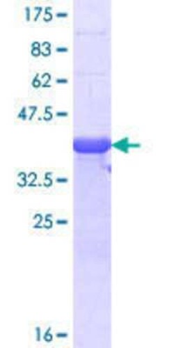 Novus Biologicals Recombinant Human RLF GST (N-Term) Protein 25 &mu;g | Buy Online | Novus Biologicals&trade; | Fisher Scientific