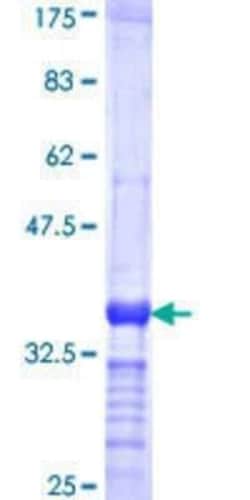 Novus Biologicals Recombinant Human Eosinophil derived neurotoxin GST (N-Term) Protein 10 &mu;g | Buy Online | Novus Biologicals&trade; | Fisher Scientific