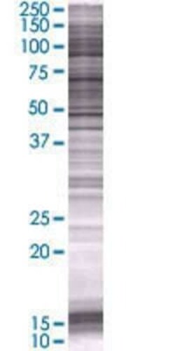 Novus Biologicals Eosinophil derived neurotoxin 293T Cell Transient Overexpression Lysate 0.1 mL | Buy Online | Novus Biologicals&trade; | Fisher Scientific
