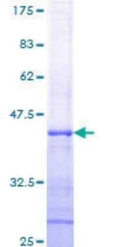 Novus Biologicals Recombinant Human RNase L GST (N-Term) Protein 2 &mu;g | Buy Online | Novus Biologicals&trade; | Fisher Scientific