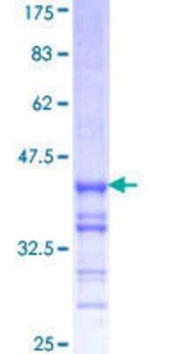 Novus Biologicals Recombinant Human RNF2 GST (N-Term) Protein 10 &mu;g | Buy Online | Novus Biologicals&trade; | Fisher Scientific