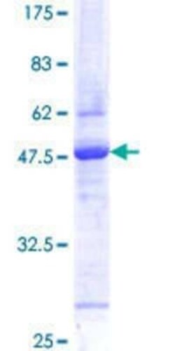 Novus Biologicals Recombinant Human RNF5 GST (N-Term) Protein 25 &mu;g | Buy Online | Novus Biologicals&trade; | Fisher Scientific