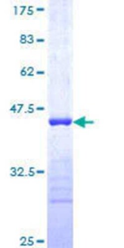 Novus Biologicals Recombinant Human RNF6 GST (N-Term) Protein 10 &mu;g | Buy Online | Novus Biologicals&trade; | Fisher Scientific