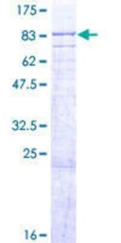Novus Biologicals Recombinant Human ABCE1 GST (N-Term) Protein 10 &mu;g | Buy Online | Novus Biologicals&trade; | Fisher Scientific