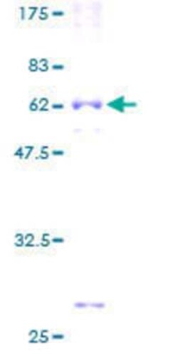 Novus Biologicals Recombinant Human ROM1 GST (N-Term) Protein 10 &mu;g | Buy Online | Novus Biologicals&trade; | Fisher Scientific