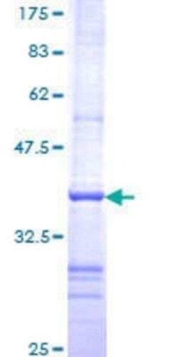 Novus Biologicals Recombinant Human ROM1 GST (N-Term) Protein 10 &mu;g | Buy Online | Novus Biologicals&trade; | Fisher Scientific