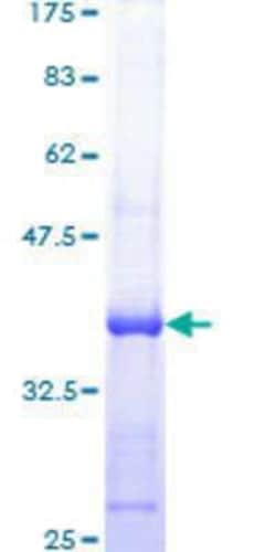 Novus Biologicals Recombinant Human RPA70 GST (N-Term) Protein 25 &mu;g | Buy Online | Novus Biologicals&trade; | Fisher Scientific
