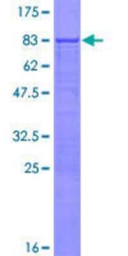 Novus Biologicals Recombinant Human RPL3L GST (N-Term) Protein 10 &mu;g | Buy Online | Novus Biologicals&trade; | Fisher Scientific