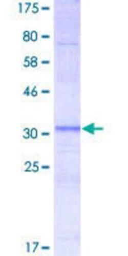 Novus Biologicals Recombinant Human RPL3L GST (N-Term) Protein 25 &mu;g | Buy Online | Novus Biologicals&trade; | Fisher Scientific