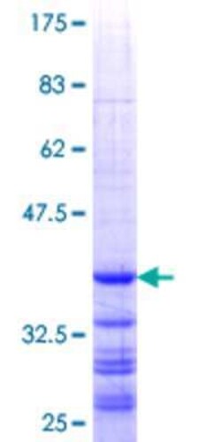 Novus Biologicals Recombinant Human RPL7 GST (N-Term) Protein 25 &mu;g | Buy Online | Novus Biologicals&trade; | Fisher Scientific