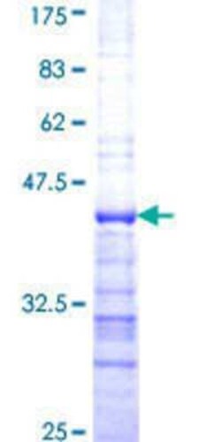 Novus Biologicals Recombinant Human RPL13 GST (N-Term) Protein 25 &mu;g | Buy Online | Novus Biologicals&trade; | Fisher Scientific
