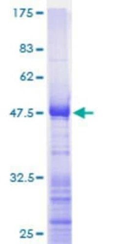 Novus Biologicals Recombinant Human Ribosomal Protein L17 GST (N-Term) Protein 25 &mu;g | Buy Online | Novus Biologicals&trade; | Fisher Scientific