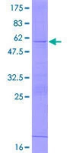 Novus Biologicals Recombinant Human RPL19 GST (N-Term) Protein 2 &mu;g | Buy Online | Novus Biologicals&trade; | Fisher Scientific
