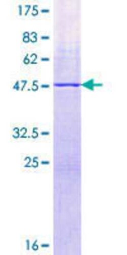 Novus Biologicals Recombinant Human RPL21 GST (N-Term) Protein 25 &mu;g | Buy Online | Novus Biologicals&trade; | Fisher Scientific