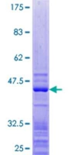 Novus Biologicals Recombinant Human RPL27 GST (N-Term) Protein 25 &mu;g | Buy Online | Novus Biologicals&trade; | Fisher Scientific