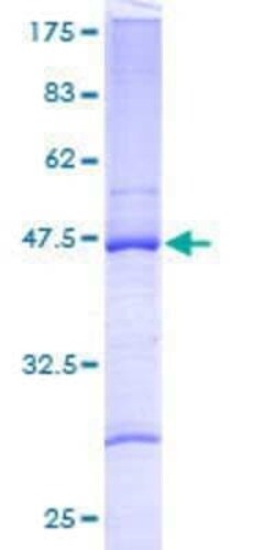 Novus Biologicals Recombinant Human RPL27A GST (N-Term) Protein 2 &mu;g | Buy Online | Novus Biologicals&trade; | Fisher Scientific