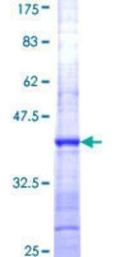Novus Biologicals Recombinant Human RPL27A GST (N-Term) Protein 25 &mu;g | Buy Online | Novus Biologicals&trade; | Fisher Scientific