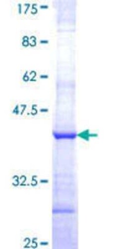 Novus Biologicals Recombinant Human RPL28 GST (N-Term) Protein 10 &mu;g | Buy Online | Novus Biologicals&trade; | Fisher Scientific