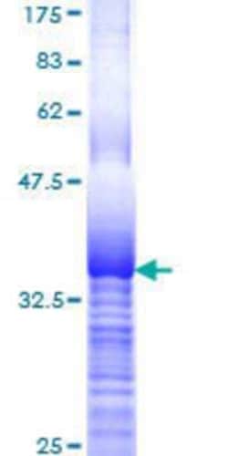 Novus Biologicals Recombinant Human RPL29 GST (N-Term) Protein 25 &mu;g | Buy Online | Novus Biologicals&trade; | Fisher Scientific