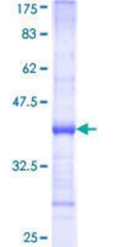 Novus Biologicals Recombinant Human RPL32 GST (N-Term) Protein 25 &mu;g | Buy Online | Novus Biologicals&trade; | Fisher Scientific