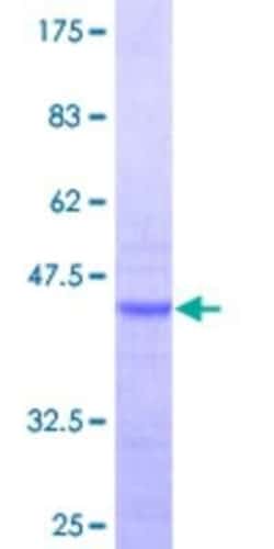 Novus Biologicals Recombinant Human RPL36AL GST (N-Term) Protein 10 &mu;g | Buy Online | Novus Biologicals&trade; | Fisher Scientific