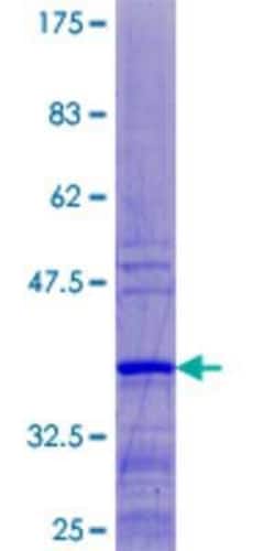 Novus Biologicals Recombinant Human RPL37 GST (N-Term) Protein 25 &mu;g | Buy Online | Novus Biologicals&trade; | Fisher Scientific