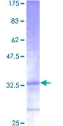 Novus Biologicals Recombinant Human RPL39 GST (N-Term) Protein 2 &mu;g | Buy Online | Novus Biologicals&trade; | Fisher Scientific